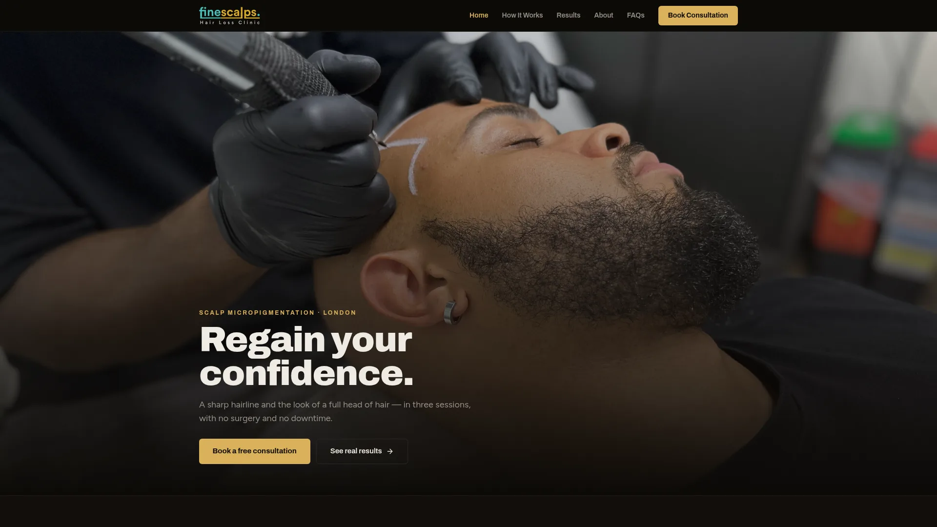Finescalps  — website design by Dilicious Studios
